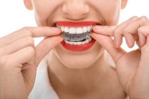 Why should I get Invisalign from my dentist in 85085?